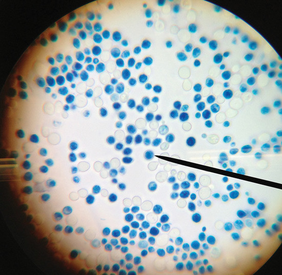 Yeast cells under the microscope